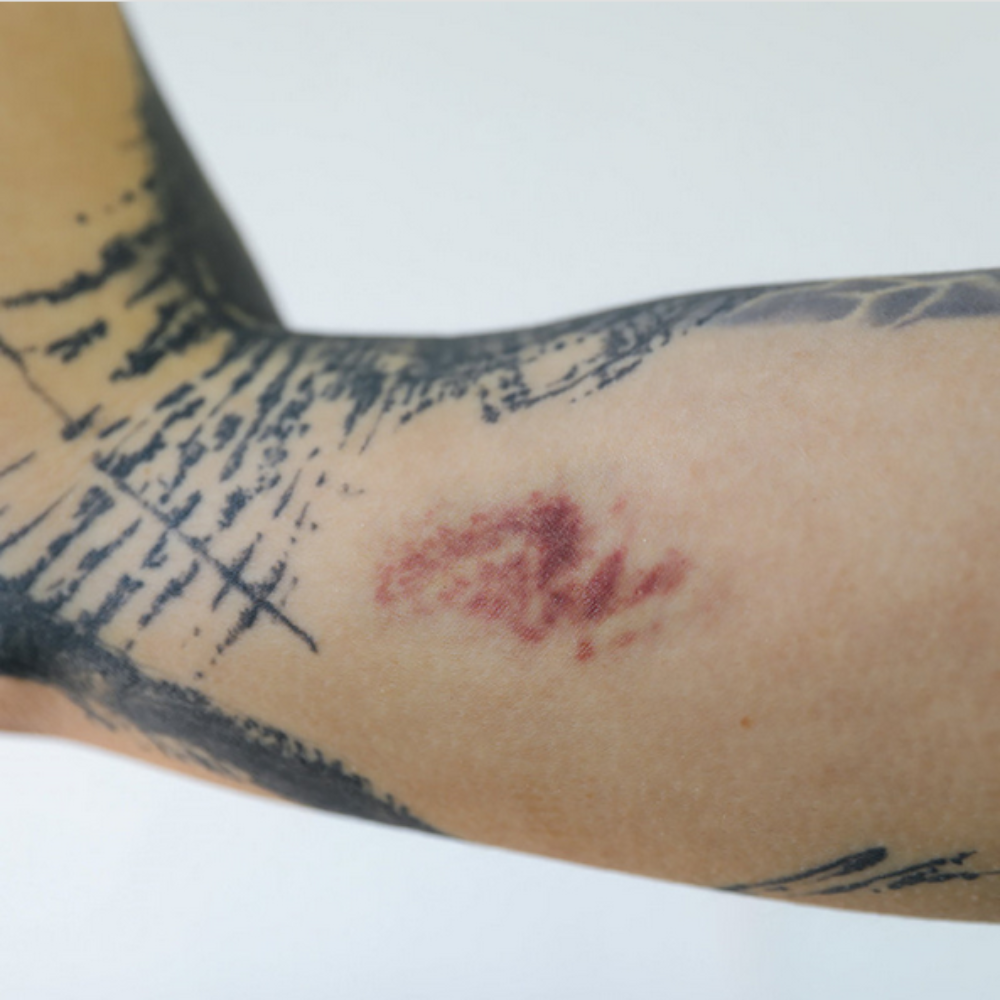 Twilight Creations Tattoo Bruises 1B
